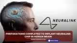 Preparations completed to implant