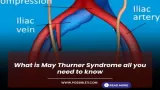 What is May Thurner