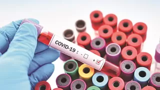 COVID-19 cases in India : जानिए कहां कितने मामले हैं?