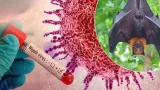 What Is Nipah Virus,