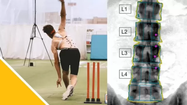 lower back injury cricket Picture