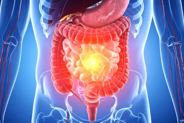 gut Picture