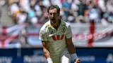 Mitchell Starc Breaks Left-Arm