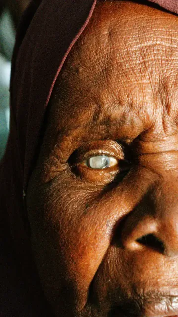 Cataract Awareness Month 2026: 5 Picture