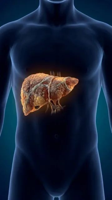 Fatty Liver Warning Signs: Early Picture
