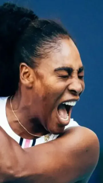 Serena Williams tweaks her knee Picture